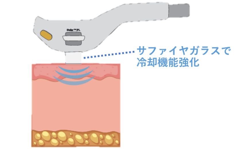 広島のシミ取り照射時の冷却機能